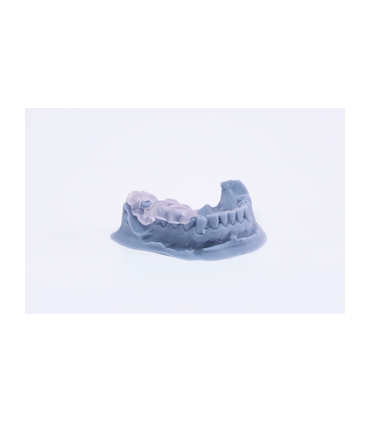 Z-Resin Raydent Surgical Guide 1L
